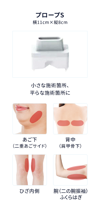 プロープS