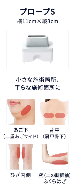 プロープS